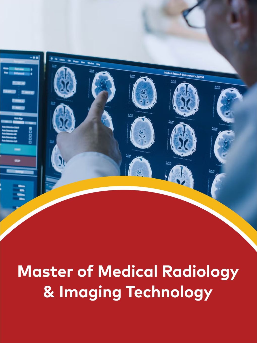 Master of Medical Radiology and Imaging Technology Eligibility, Fees, Admission & Career Scope